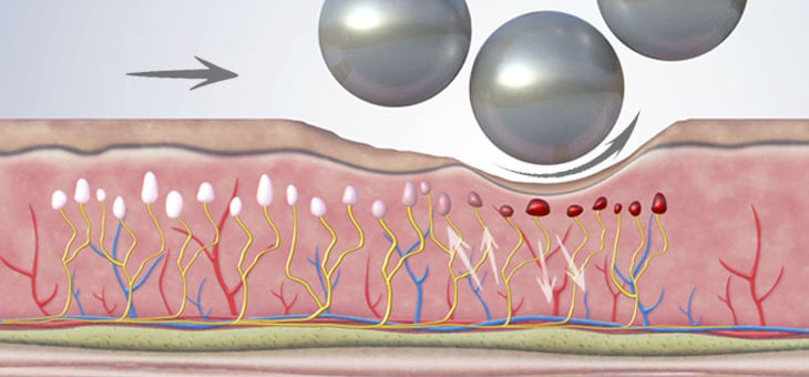 analgestic
