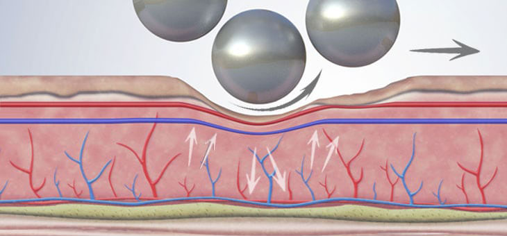 vascular